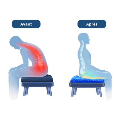 Confortis - coussin de siège - ErgoSeat™